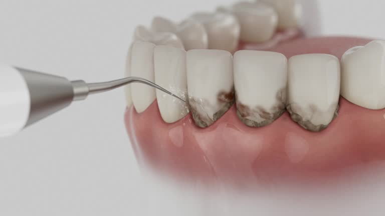 Reliable Emergency Dentist contractor in Crosby, ND by Smile Center Dentistry
